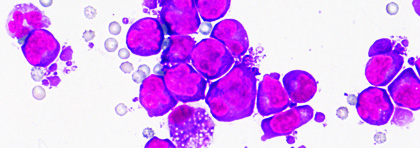 cytology large