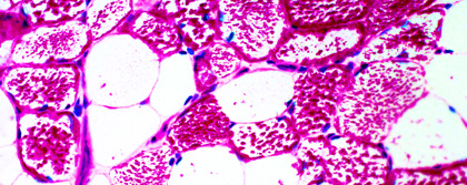 EBP neuromuscular