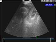 thoracic6