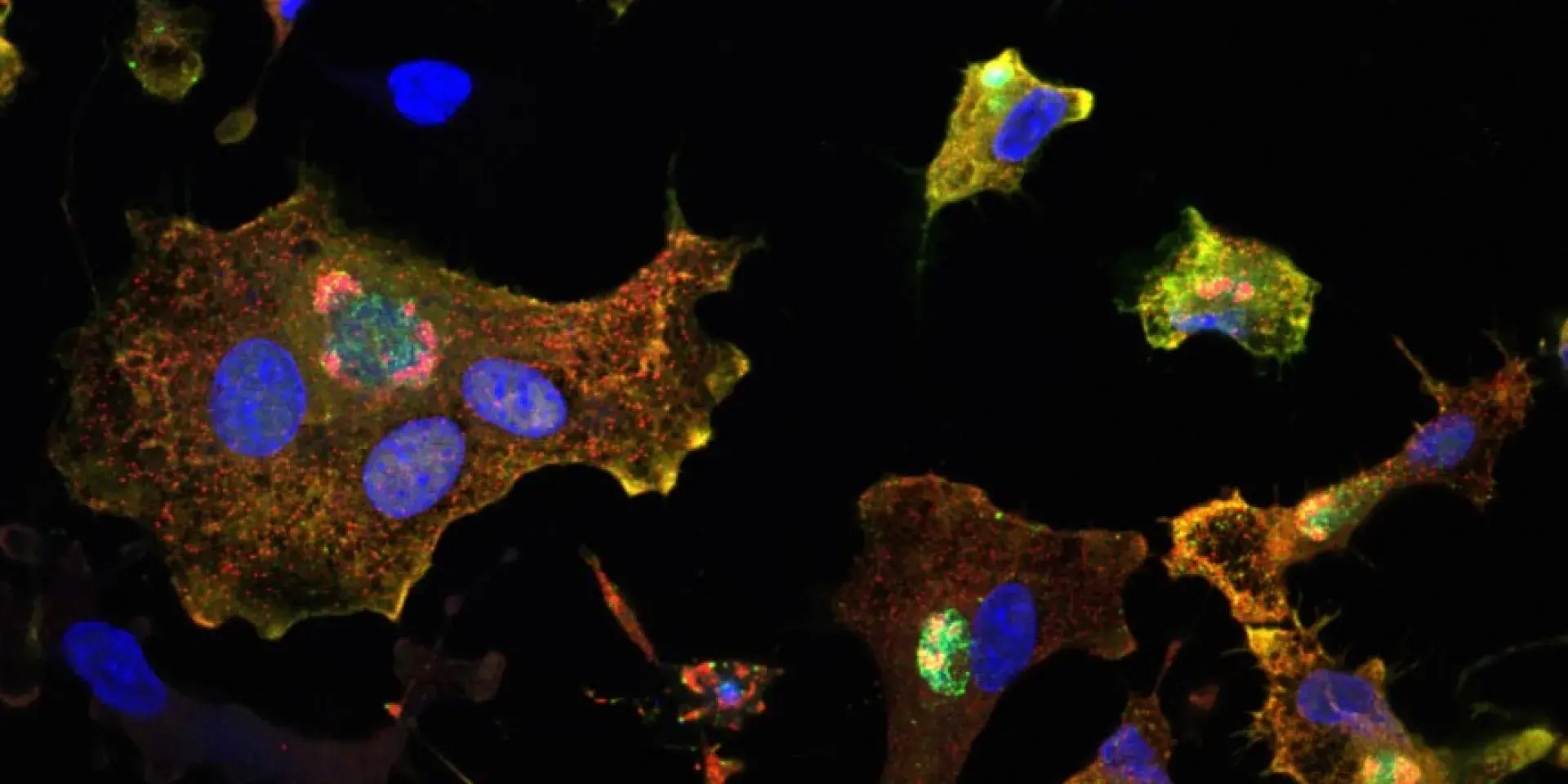 pig iPSC derived macs infected with ASFV