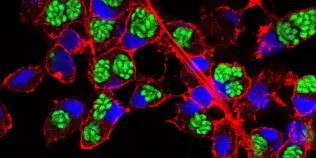 Pig PSC-derived macrophages infected with GFP-lebelled Toxoplasma gondii