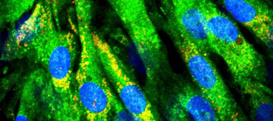 A brightly coloured microscopic image shows yellow-stained proteins.