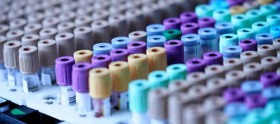 image of multiple blood sample tubes 