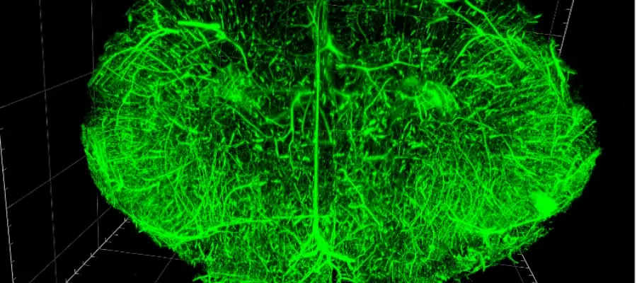 Lightsheet Microscopy
