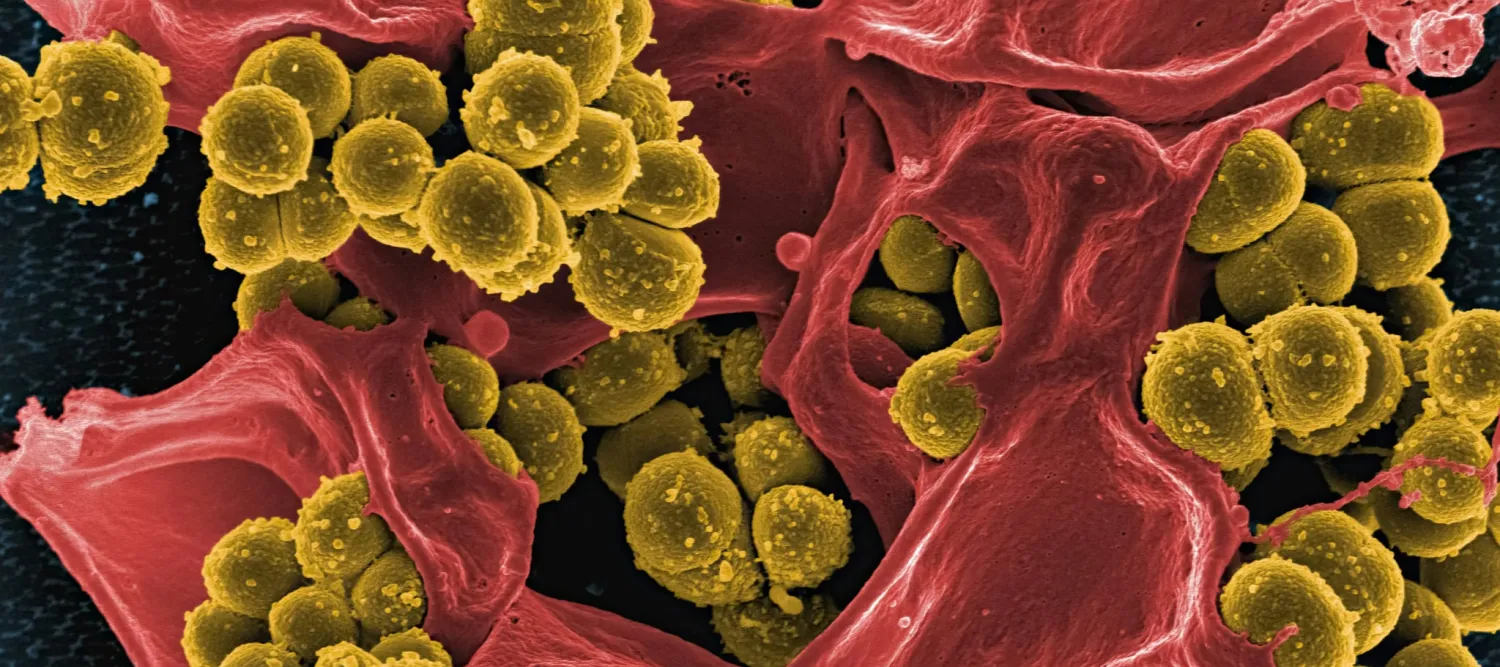 Methicillin-Resistant Staphylococcus aureus (MRSA) Bacteria seen through an electron micrograph