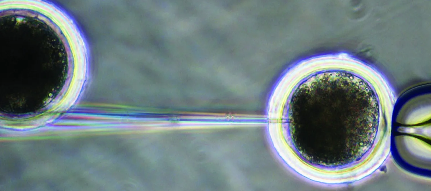 Microinjection as viewed through a microscope