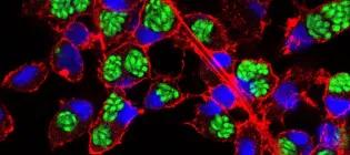 Pig PSC-derived macrophages infected with GFP-lebelled Toxoplasma gondii