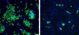 Side-by-side microscopy images showing stem cells with CD13 (left) and without CD13 (right) on their surface. Green specks can be seen on the left image on the right 