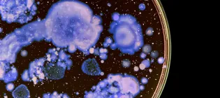 Purple-stained bacteria is seen in a clear, circular petri dish
