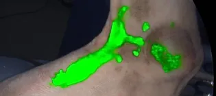 leg of dog with lymphatic pathways highlighted by green flourescent dye