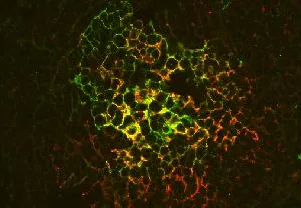 Immune systems fighting prions; older might be better