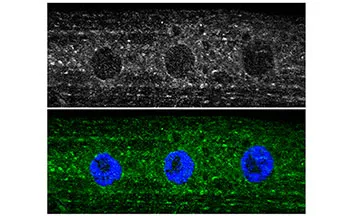 Plant extract offers hope for infant motor neurone therapy