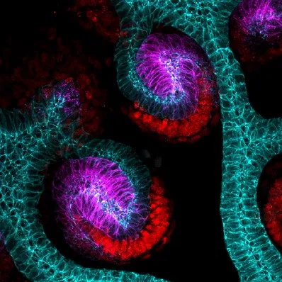 Image of kidneys growing nephrons