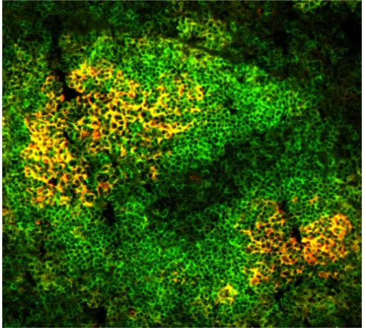 Follicular dendritic cells