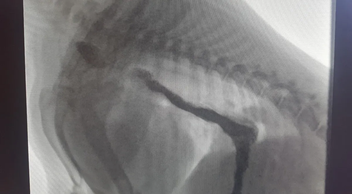 In a live fluoroscopy image, contrast appears black as it moves through the food pipe.