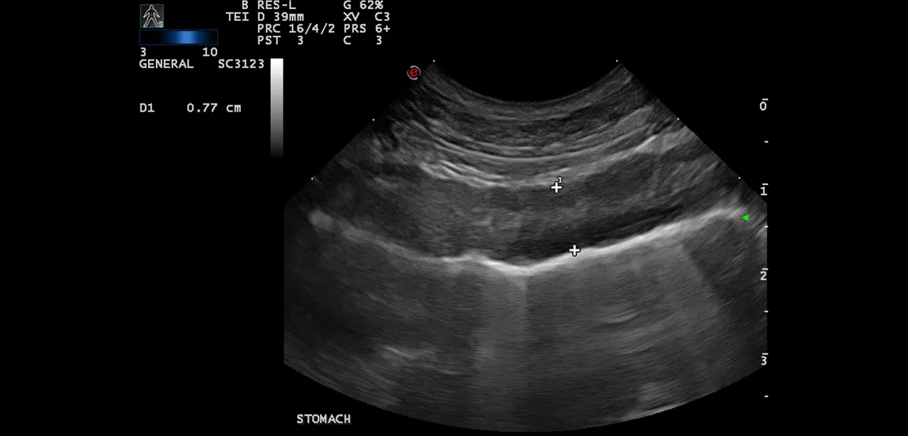 Ultrasound image of the stomach wall of a dog.