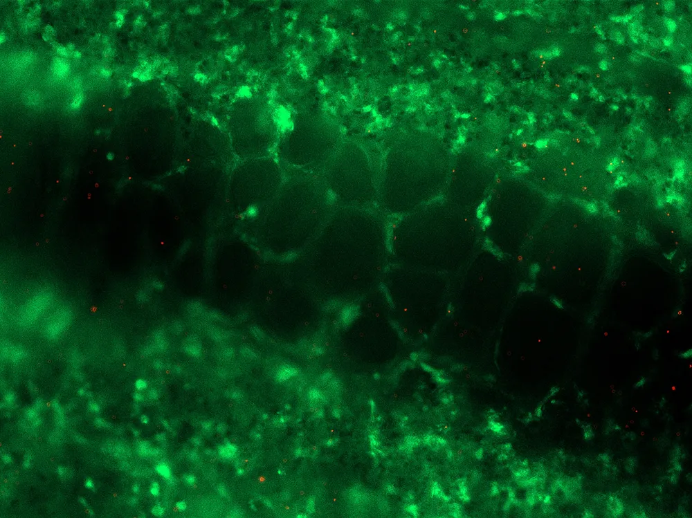 Fluorescent green immune cells