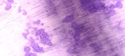 Damage on cat dental tissue.