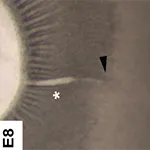 Closure of the Optic Fissure Margin