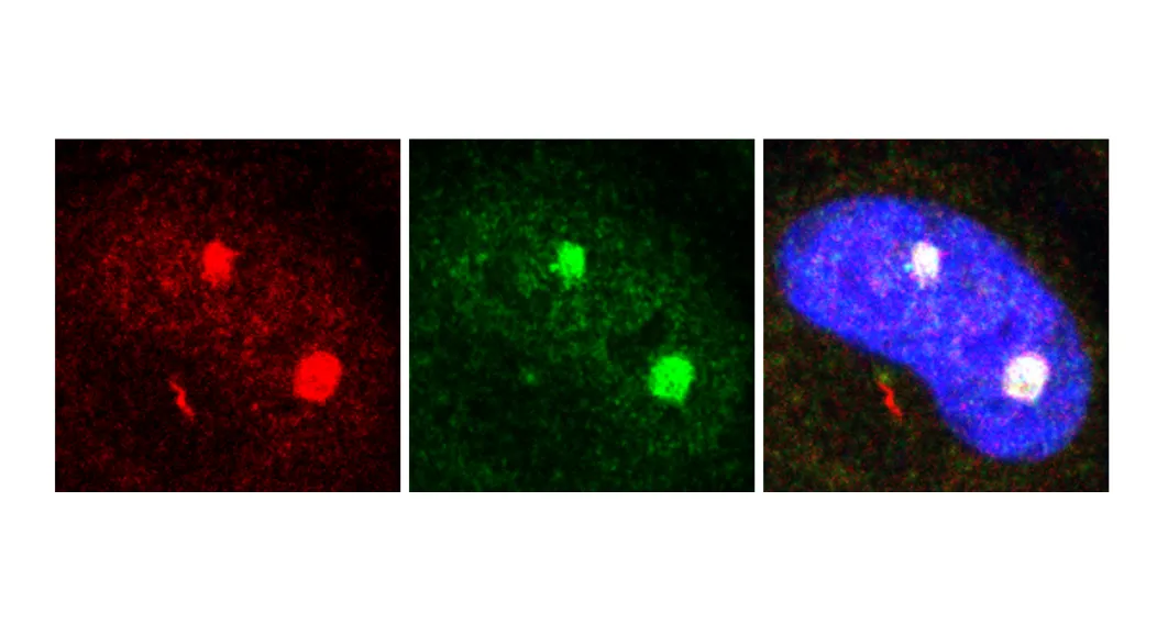 Costaining of VCP and IE2 showing localization of VCP to the viral replication compartments in the nucleous