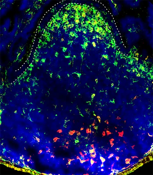 Disturbed distribution of immune cells in a Peyer’s patch during worm infection.