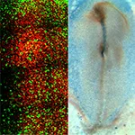  SHH and VANGL2- Breaking Symmetry