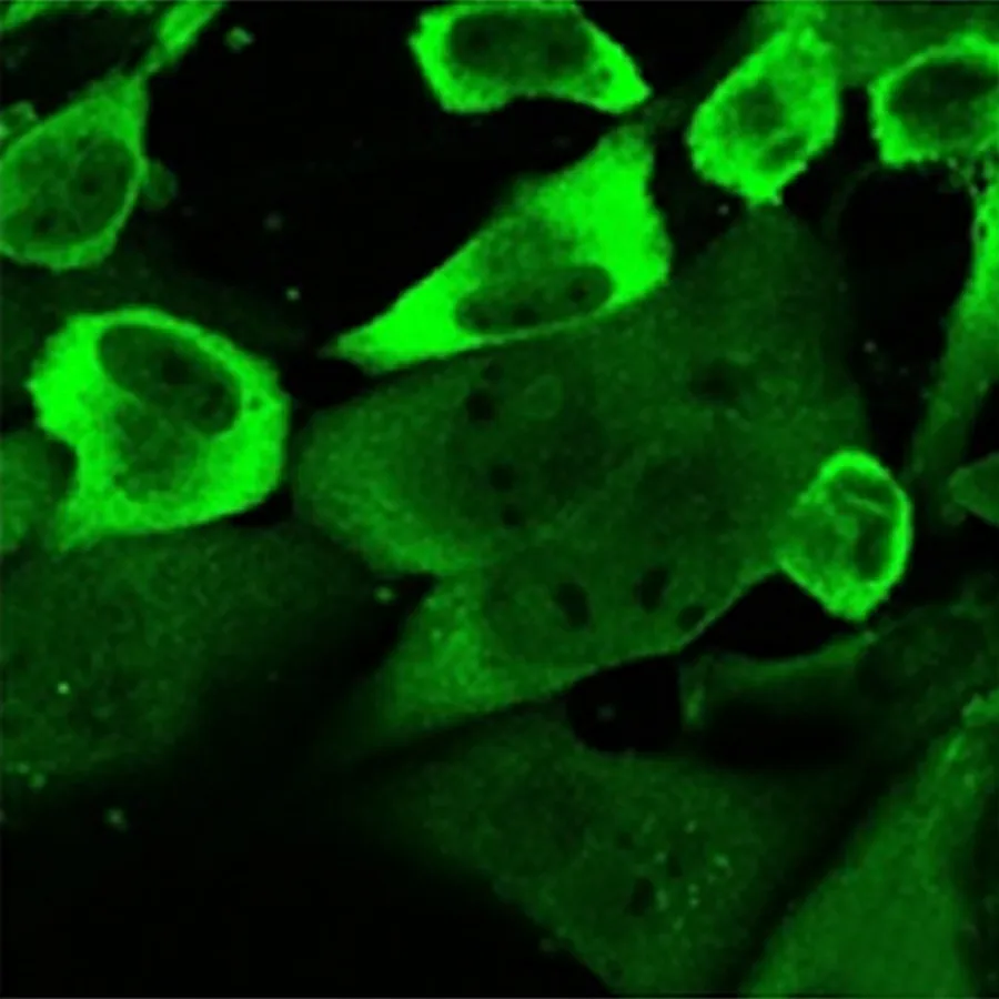 Microscope image of ZAP expression