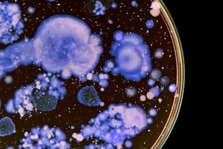 Purple-stained bacteria is seen in a clear, circular petri dish