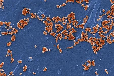 This scanning electron micrograph (SEM) depicted numerous clumps of methicillin-resistant Staphylococcus aureus bacteria, commonly referred to by the acronym, MRSA; Magnified 2381x.