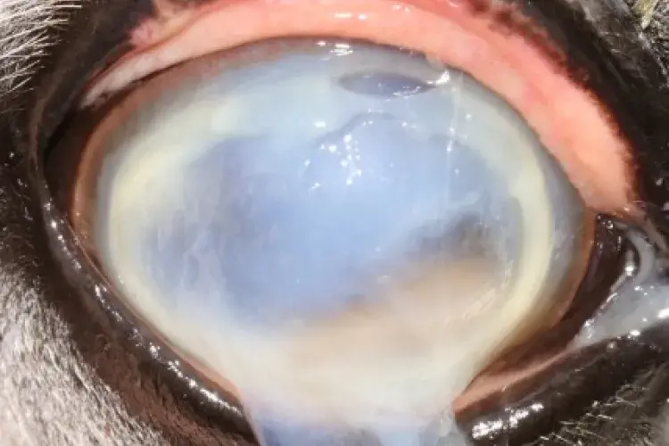 Ophthalmic surgery 