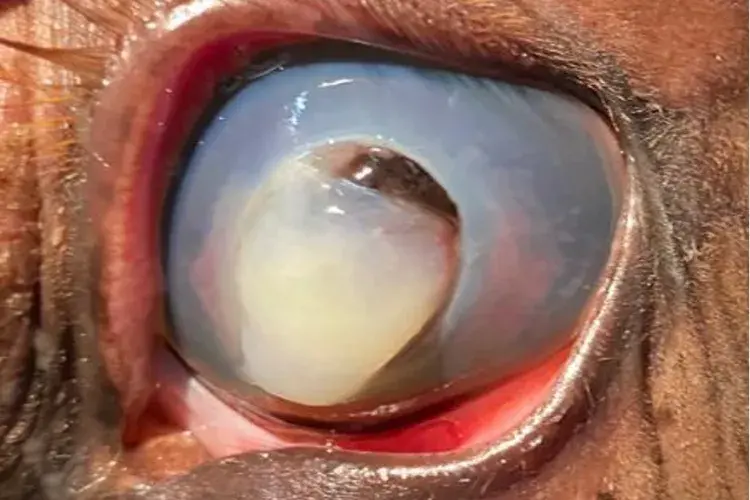 Ophthalmic surgery 