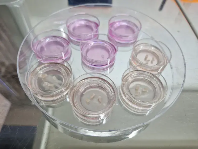 Eight petri dishes on a circular plate each contain small samples of brain tissue, ready for use in the lab.