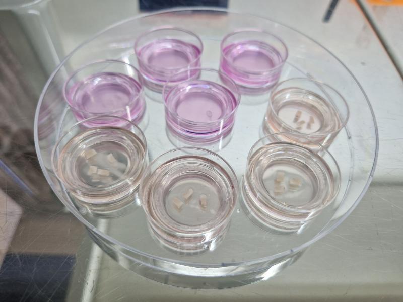 Eight petri dishes on a circular plate each contain small samples of brain tissue, ready for use in the lab.