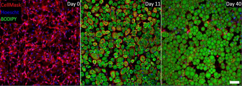 Stem cells turning into fat cells over a span of 40 days. Accumulated fat is shown in green.