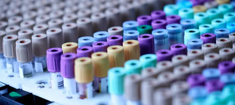 image of multiple blood sample tubes 