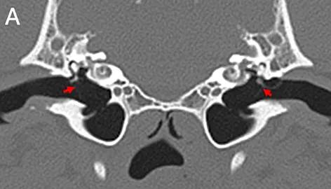 CT scan image