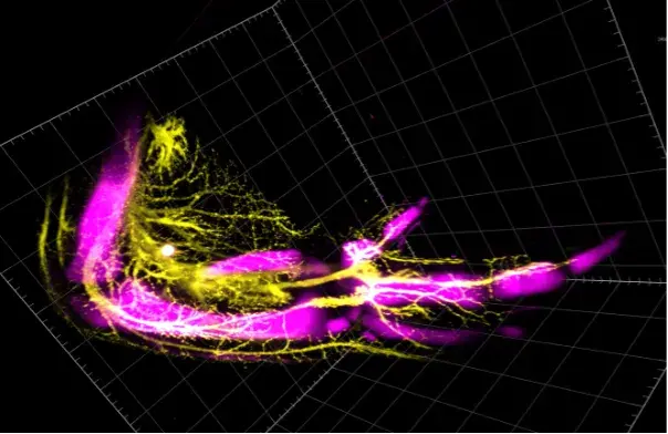 In Situ Hybridisation of a chick embryo Wing to Look at Bones (magenta) and Nerve (yellow)