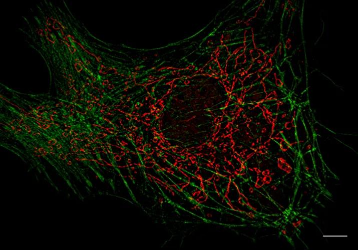 Zeiss Elyra 7 with Lattice SIM²