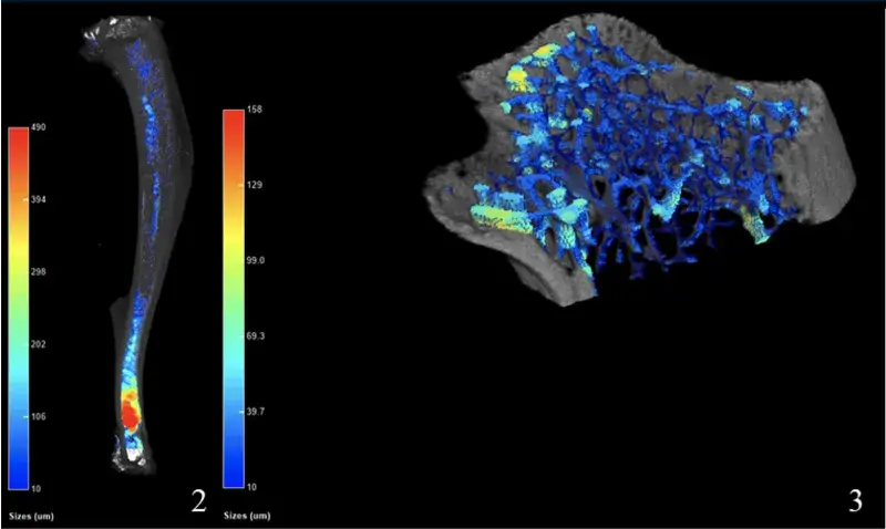 2.Quantification of osmium stained adipocytes in CKD mouse bone. 3.Quantification of trabecular bone in proximal region of mouse tibial bone.