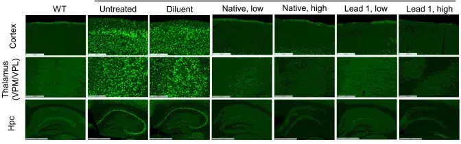 Scans of mice brains. From left to right: Control mice, mice with Batten disease, and mice treated with the new therapy. Harmful waste buildup is reduced in mice receiving treatment.