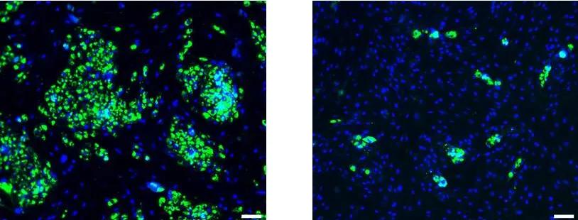 side-by-side microscope images showing stem cells with (left) and without (right) the CD13 protein on their surface. The cells displaying CD13 show green specks, representing fat, on their surface. 