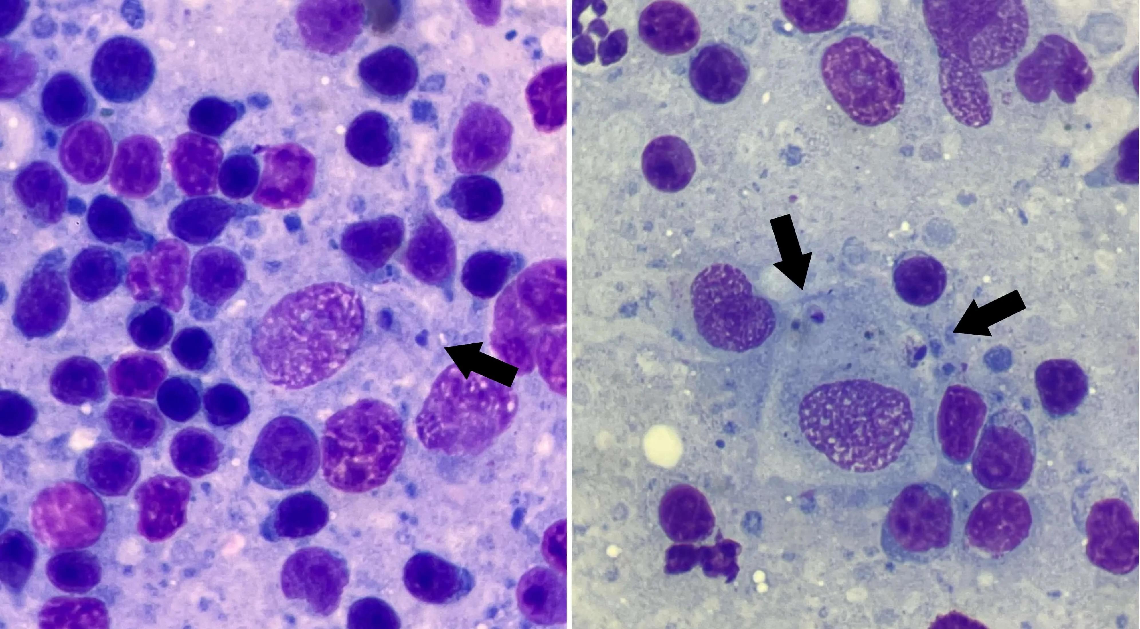 Cytological images of lymph nodes from a dog showing macrophages containing few Leishmania amastigotes (arrows)