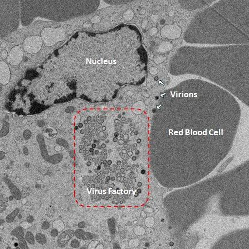 A black and white microscopic image of an infected immune cell, showing virus particles attached to the cell and generating within the cell