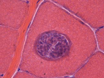Sarcocyst