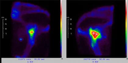 Equine Scintigraphy