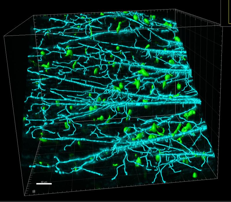 Multiphoton image, macrophages (macgreen) in cardiac muscle (Blue, SHG)