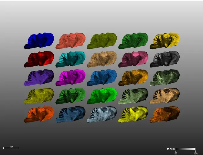 Methods Imaging MS