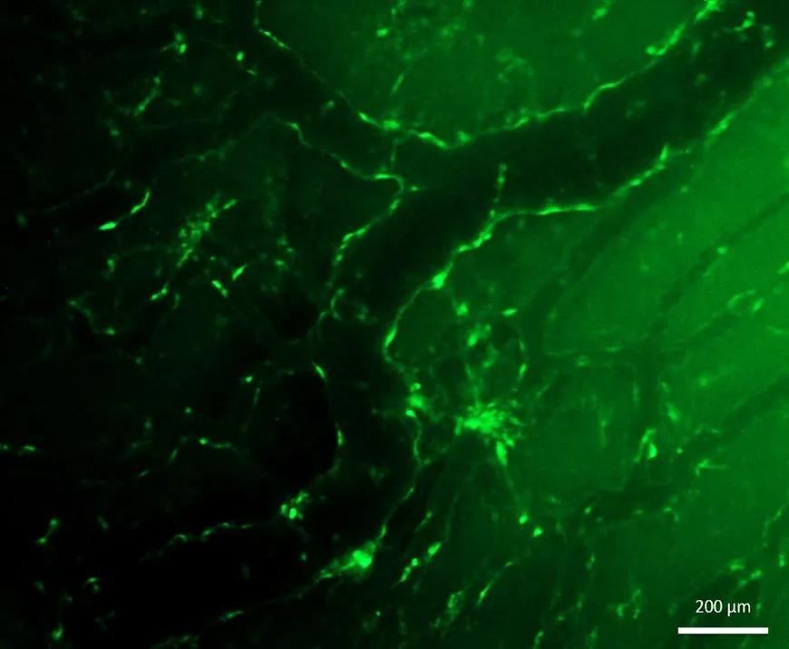 Split GFP