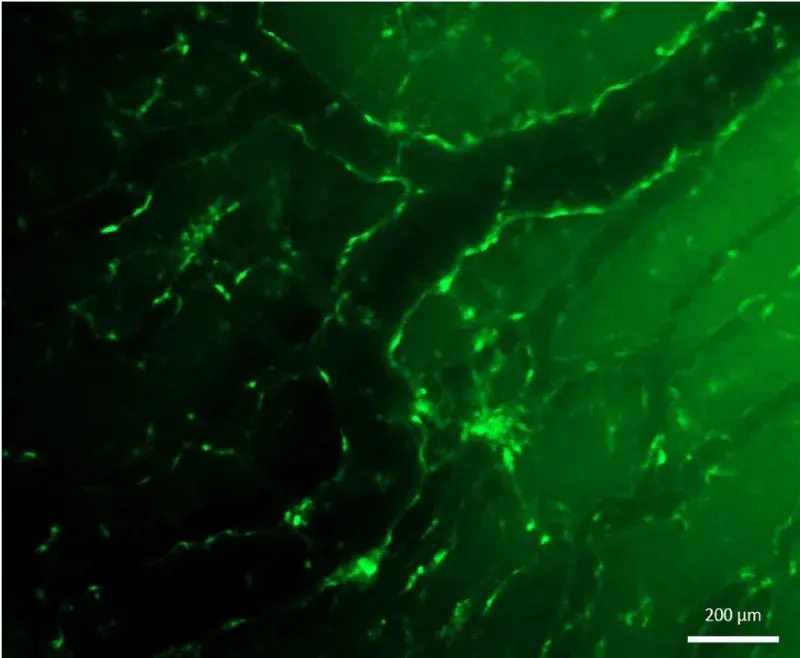 Split GFP