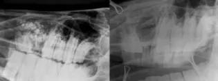 horse radiograph